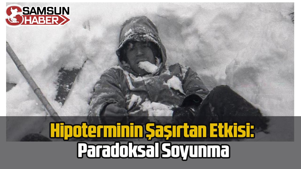 Hipoterminin Şaşırtan Etkisi: Paradoksal Soyunma